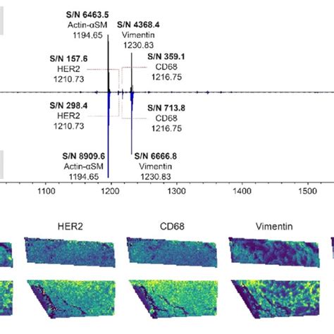 Timstof Maldi 1 Vs Maldi 2 On Breast Cancer Tissue Samples From Patient Download Scientific