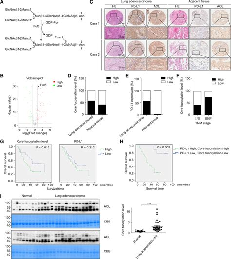 Fut8 And PDL1 Were Upregulated In Lung Adenocarcinoma A The