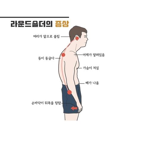 라운드숄더의 원인과 증상 예방법 네이버 블로그