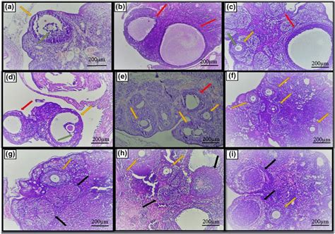 Photomicrograph Of Ovarian Tissue H E Staining Scale Bar