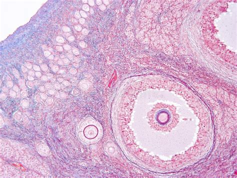 Histology Of Ovary Human Tissue Stock Image Image Of Study