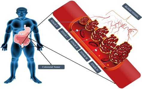 Frontiers | Recent advances in nanomedicine preparative methods and ...