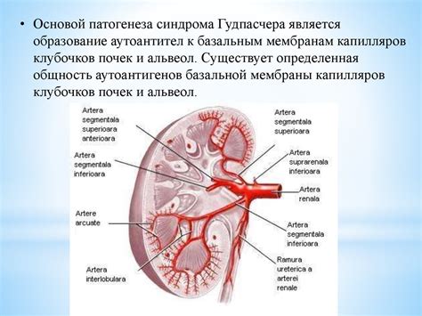 Синдром Гудпасчера - презентация онлайн