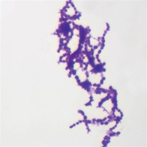 Streptococcus Pyogenes Gram Stain