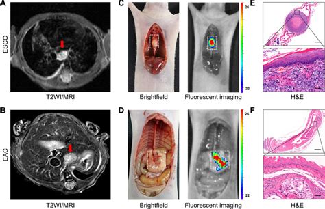 In Vivo Fluorescent Imaging With Bispecific Probe In Orthotopic EC