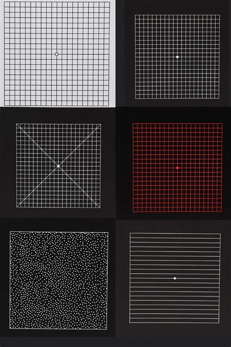 Different Types Of Amsler Charts