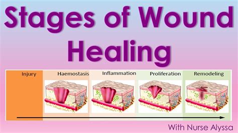 4 Stages Of Wound Healing Wound Healing Healing Color Change Images