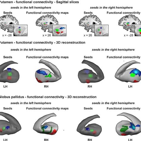 Whole Brain Functional Connectivity Analysis Reveals Interhemispheric Download Scientific