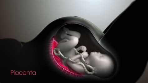 Medical Animation Showing Cesarean Section Surgery