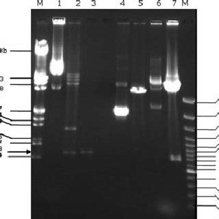 Immunoprecipitation Showing Age And Sex Dependent Interaction Of In