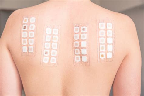 Patch Test Cosmetic Testing Lab