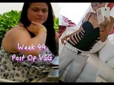 Week Post Op Gastric Sleeve Vsg Update Youtube