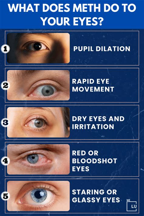 What Are Meth Eyes? What Does Meth Do To Your Eyes?