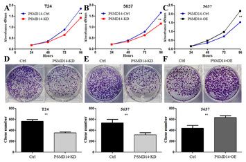 Depletion Of PSMD14 Suppresses Bladder Cancer Proliferation By