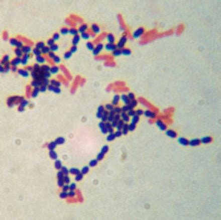 Lab The Gram Stain Flashcards Quizlet