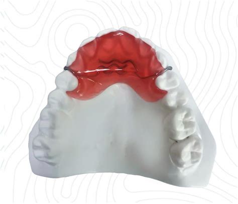 Anterior Bite Plate Ort Orthodontics Orthodontic Appliances Orthodontia