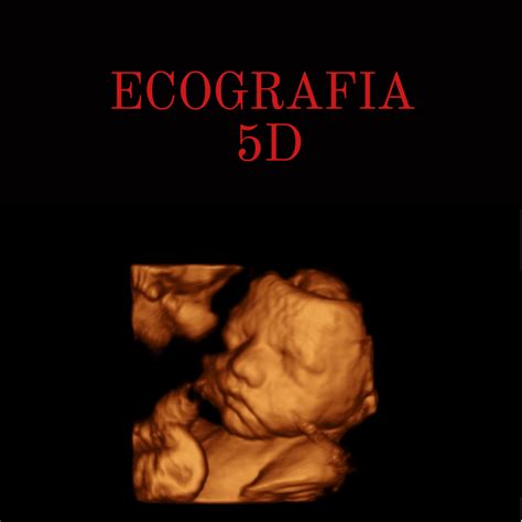 Ecograf A Emocional D Obstetrix