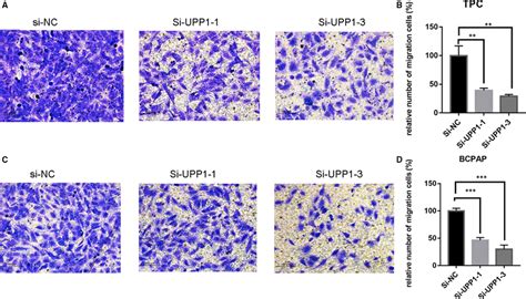 Down‐regulation Of Upp1 Gene Expression In Tpc And Bcpap Cells Inhibits