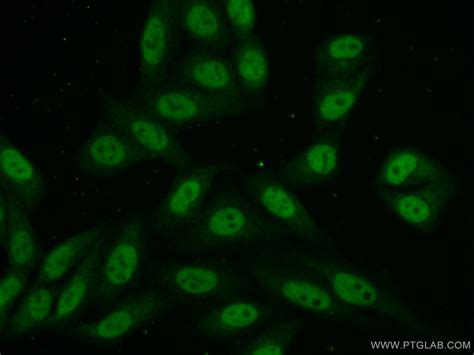 Ncapd3 Antibody 16828 1 Ap Proteintech 武汉三鹰生物技术有限公司