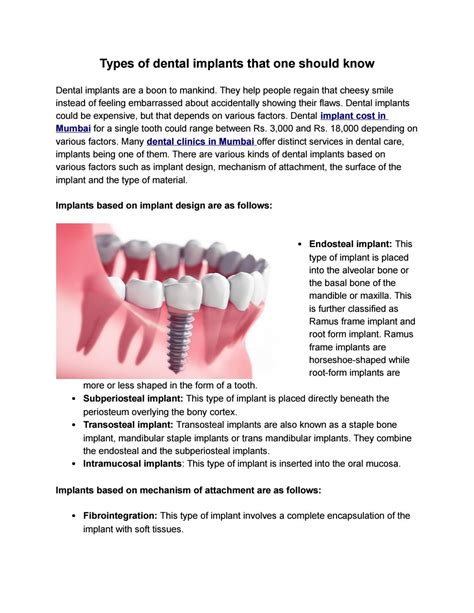 Types Of Dental Implants That One Should Know By Ashdin Turner Issuu