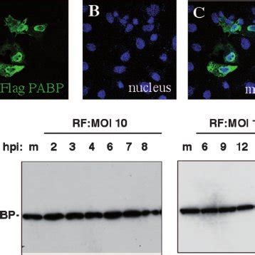 Localization Of PABP C1 In Rotavirus Infected And Uninfected Stressed