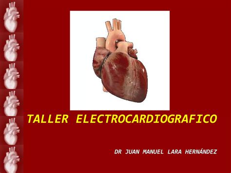 Taller Ekg 2 PPT Descarga Gratuita