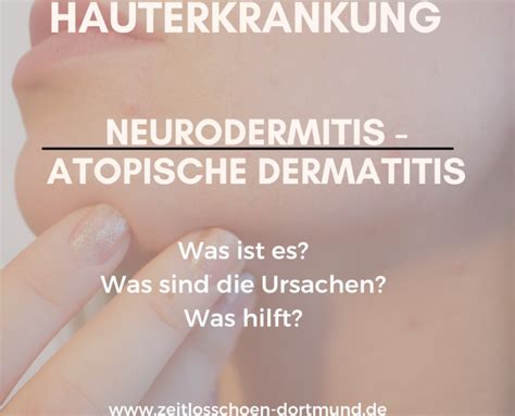 Hauterkrankung - Atopische Dermatitis - Zeitlos Schön