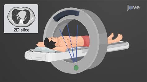 Computed Tomography Anatomy And Physiology Jove