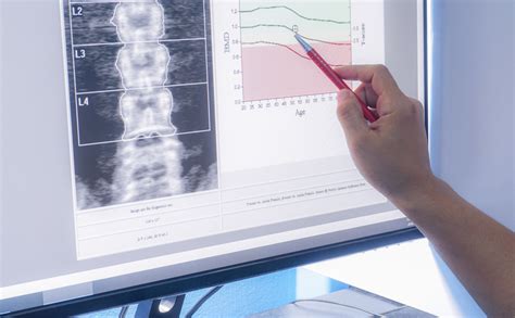 Bone Mineral Densitometry For Mrts Didactic Component