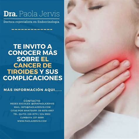 Qué es el Cáncer de Tiroides y Cuáles son los síntomas