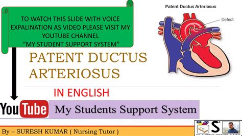 Patent Ductus Arteriosus In English Ppt Free Download