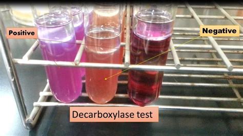 Lysine Decarboxylase Test Reaction