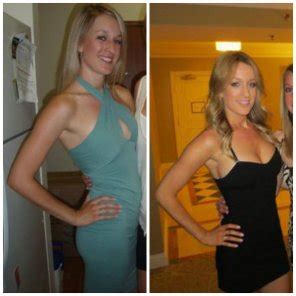 Before And After Boob Job Porn Photos