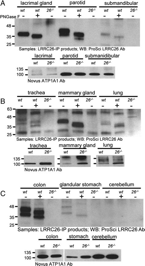 Detection Of LRRC26 Protein In Lrrc26 Message Rich Mouse Tissues A