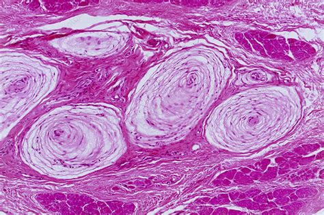 Pacinian Corpuscle Structure