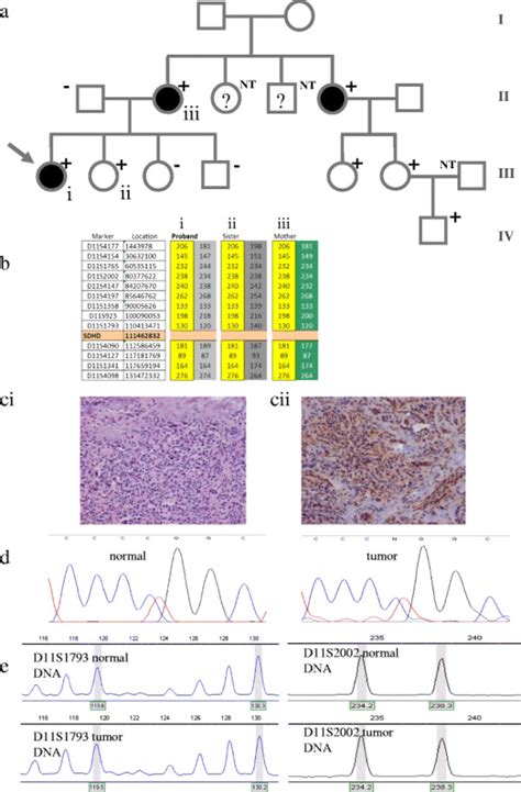 Patient Pedigree Dna And Tumor Analysis A Arrow Indicates The