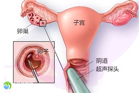 2024南昌市做三代试管婴儿最厉害的医院排名更新 全民健康网