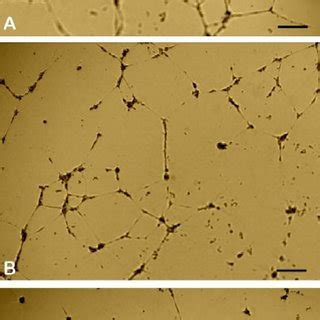 Inhibition Of The In Vitro Angiogenesis Of Human Umbilical Vein