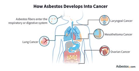 What Types Of Cancers Are Caused By Asbestos