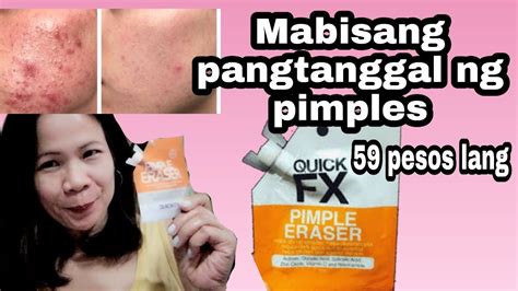 Gamot Sa Pimples QUICKFX Pimple Eraser Ang Bilis Matuyo Ng Pimples