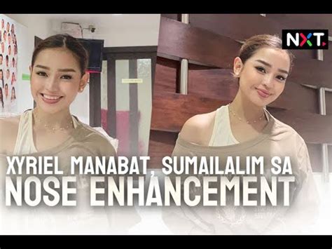 Xyriel Manabat Sumailalim Sa Nose Enhancement Youtube