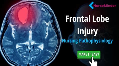 Front Lobe Damage 3 Words To Remember For Nursing Students YouTube