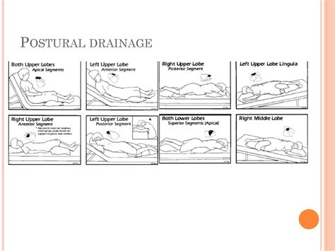 Postural Drainage Positions Pdf