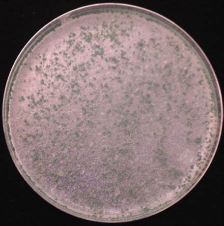 Morphological Identification Of Jx Trichoderma Asperellum Ac