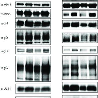 Western Blot Analysis Of Viral Protein Expression Levels In Infected