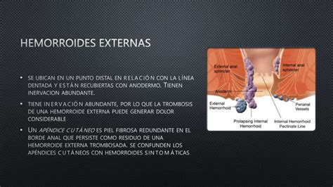 Patologia Anorectal Hemorroides Abscesos Fistulas Y Fisura Pptx