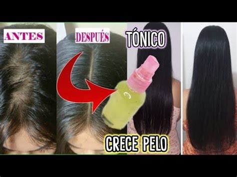 T Nico Crece Pelo Extremo Magia En Tu Cabello Youtube Crecer Pelo