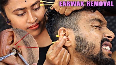 Massive Earwax Removal Ear Cleaning By Barber Girl Pakhi Head