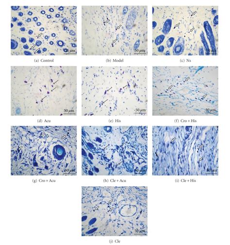 Mast cells in the skin and connective tissue near the acupoint area ...