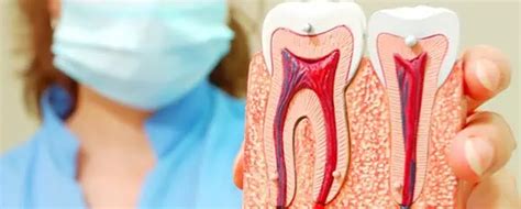 Qué es el trismus dental Causas síntomas y tratamiento